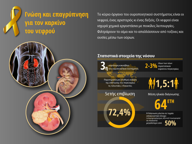 bannerMediumKidney cancer bouzalas urology