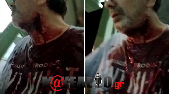 Δολοφονική επίθεση | Η κίνηση που έσωσε τον Στέφανο Χίο από (νέες σκληρές εικόνες)