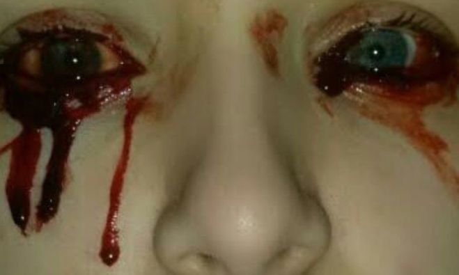 Μυστήριο - Η 17χρονη που τρέχει αίμα από τα μάτια της ...