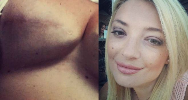 &Eta; &Epsilon;&lambda;&lambda;&eta;&nu;ί&delta;&alpha; &pi;&omicron;&upsilon; &nu;ί&kappa;&eta;&sigma;&epsilon; &tau;&omicron;&nu; &kappa;&alpha;&rho;&kappa;ί&nu;&omicron; &delta;&epsilon;ί&chi;&nu;&epsilon;&iota; &tau;&eta; &delta;&iota;&pi;&lambda;ή &mu;&alpha;&sigma;&tau;&epsilon;&kappa;&tau;&omicron;&mu;ή &tau;&eta;&sigmaf; ... &gamma;&iota;&alpha; &nu;&alpha; &alpha;&phi;&upsilon;&pi;&nu;ί&sigma;&epsilon;&iota; &tau;&iota;&sigmaf; &gamma;&upsilon;&nu;&alpha;ί&kappa;&epsilon;&sigmaf;