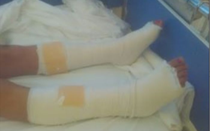 Ατύχημα - σοκ στην κολυμπήθρα της Τήνου | 28χρονη έπεσε από ύψος πέντε μέτρων