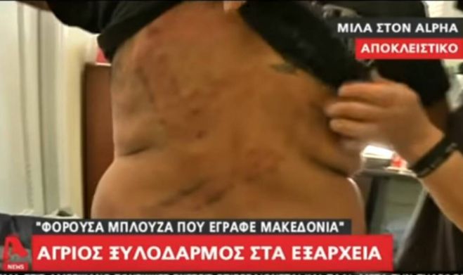 Εξάρχεια | Σάπισαν στο ξύλο έναν 45χρονο επειδή φορούσε ένα μπλουζάκι για τη Μακεδονία (vd)