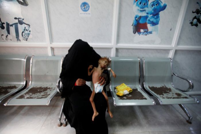 Πάνω από 2.000.000 παιδιά υποσιτίζονται στην Υεμένη ...