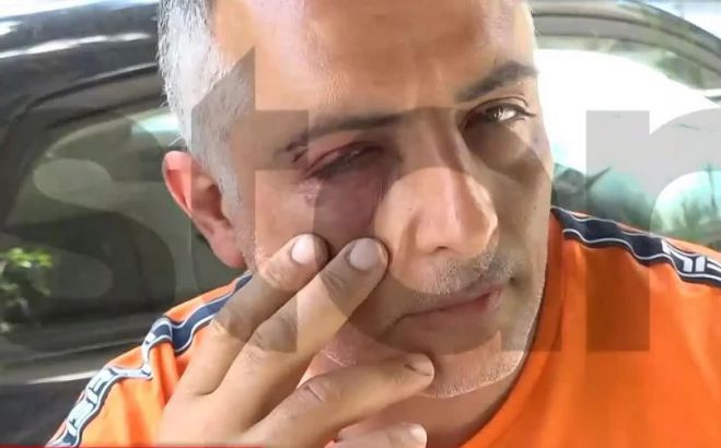 Δύο Πακιστανοί κι ένας Αλβανός ξυλοκόπησαν ελεγκτή εισιτηρίων σε λεωφορείο (vd)