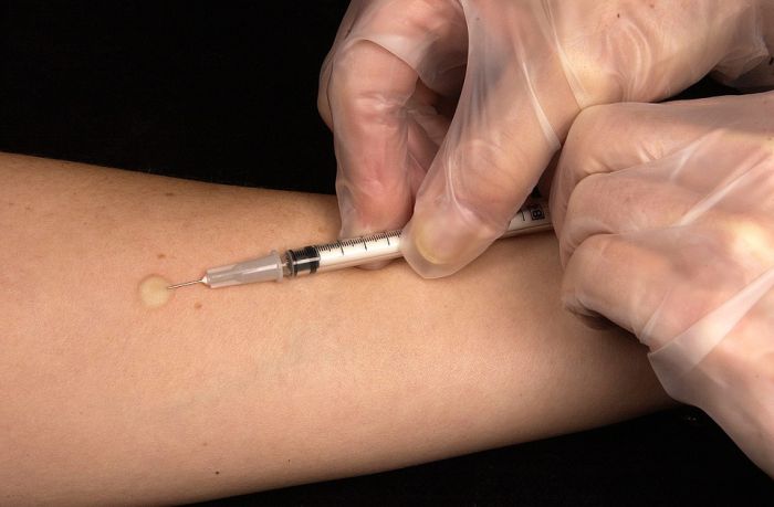 Υγεία | Τα οφέλη του εμβολιασμού στον ενήλικα πληθυσμό