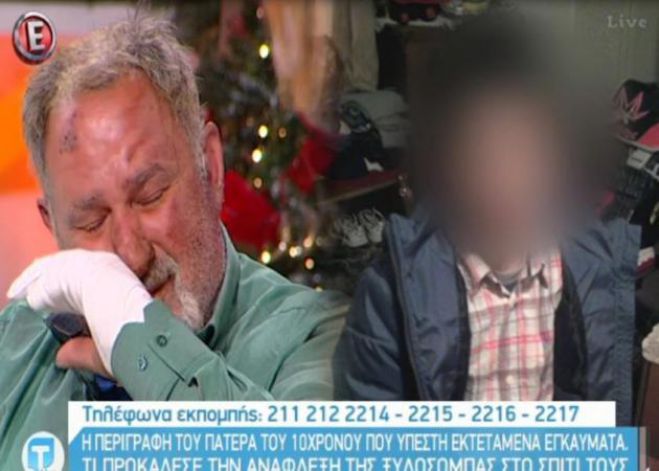 Ξέσπασε σε δάκρυα ο πατέρας του 10χρονου που κάηκε στη φωτιά από τη ξυλόσομπα (vd)