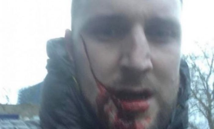 &Sigma;&omicron;&kappa; | Έ&tau;&sigma;&iota; &epsilon;ί&nu;&alpha;&iota; &tau;ώ&rho;&alpha; &omicron; &omicron;&pi;&alpha;&delta;ό&sigmaf; &pi;&omicron;&upsilon; &mu;&alpha;&chi;&alpha;&iota;&rho;ώ&theta;&eta;&kappa;&epsilon; &sigma;&tau;&omicron; &pi;&rho;ό&sigma;&omega;&pi;&omicron; - &Delta;&epsilon;ί&tau;&epsilon; &tau;&eta; &phi;&omega;&tau;&omicron;&gamma;&rho;&alpha;&phi;ί&alpha;!