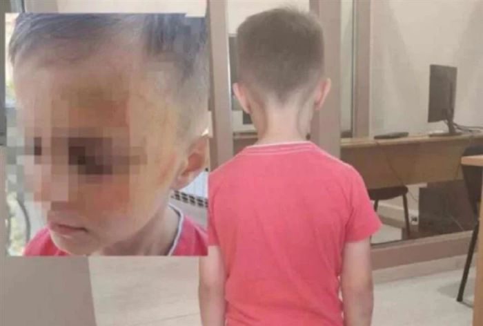 Εικόνες ντροπής στο Αγρίνιο | Άγριος ξυλοδαρμός 5χρονου από συμμαθητές του