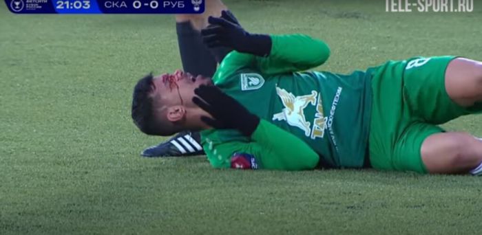 &Phi;&rho;&iota;&chi;&tau;ό&sigmaf; &tau;&rho;&alpha;&upsilon;&mu;&alpha;&tau;&iota;&sigma;&mu;ό&sigmaf; &sigma;&epsilon; &pi;&omicron;&delta;&omicron;&sigma;&phi;&alpha;&iota;&rho;&iota;&kappa;ό &gamma;ή&pi;&epsilon;&delta;&omicron; (vd)