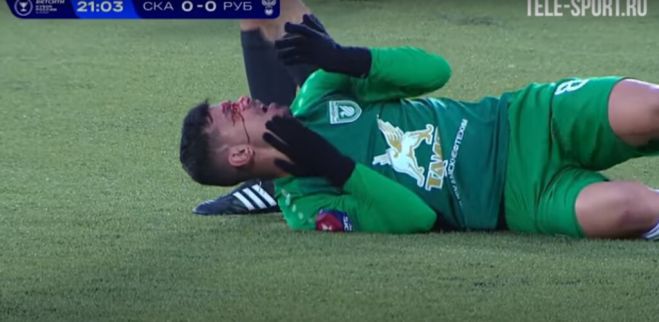 &Phi;&rho;&iota;&chi;&tau;ό&sigmaf; &tau;&rho;&alpha;&upsilon;&mu;&alpha;&tau;&iota;&sigma;&mu;ό&sigmaf; &sigma;&epsilon; &pi;&omicron;&delta;&omicron;&sigma;&phi;&alpha;&iota;&rho;&iota;&kappa;ό &gamma;ή&pi;&epsilon;&delta;&omicron; (vd)