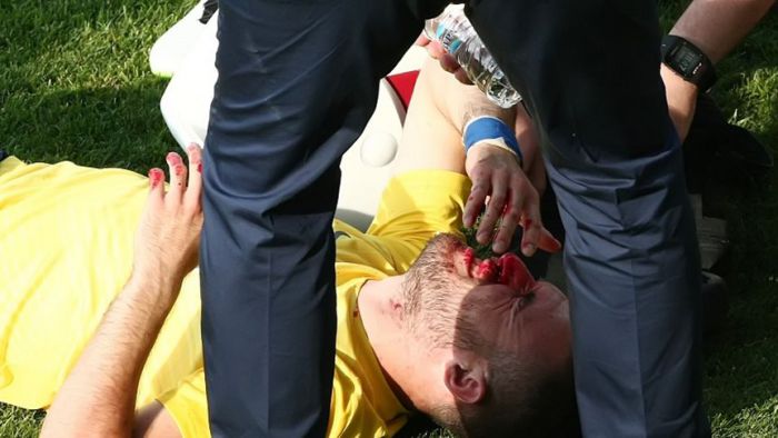 Γέμισε αίματα το πρόσωπο του Γιαννιώτα στη Λεωφόρο (vd)