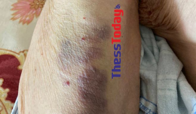 &Nu;&tau;&omicron;&kappa;&omicron;&upsilon;&mu;έ&nu;&tau;&omicron;-&sigma;&omicron;&kappa; &alpha;&pi;ό &tau;&omicron;&nu; &xi;&upsilon;&lambda;&omicron;&delta;&alpha;&rho;&mu;ό 98&chi;&rho;&omicron;&nu;&omicron;&upsilon; &sigma;&tau;&omicron; &Pi;&alpha;&pi;&alpha;&gamma;&epsilon;&omega;&rho;&gamma;ί&omicron;&upsilon; &ndash; &laquo;&Phi;ώ&nu;&alpha;&zeta;&epsilon; &beta;&omicron;ή&theta;&epsilon;&iota;&alpha;&raquo;