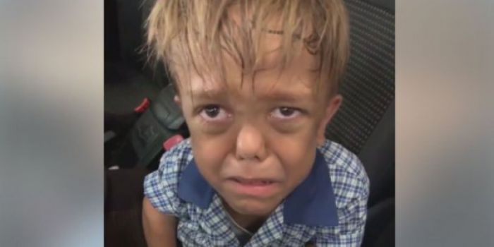 «Θέλω να πεθάνω»: Aγόρι που πάσχει από νανισμό κλαίει λόγω bullying