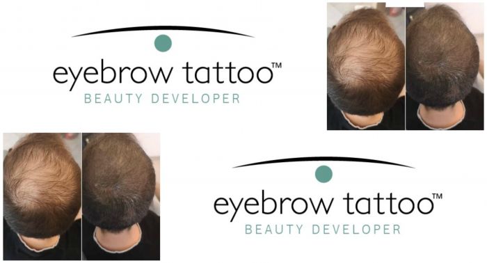 &Gamma;&nu;&omega;&rho;ί&zeta;&epsilon;&tau;&epsilon; ό&tau;&iota; &upsilon;&pi;ά&rho;&chi;&epsilon;&iota; &tau;&epsilon;&chi;&nu;&iota;&kappa;ή &kappa;&alpha;&iota; &gamma;&iota;&alpha; &tau;&omicron; &tau;&rho;&iota;&chi;&omega;&tau;ό &tau;&eta;&sigmaf; &kappa;&epsilon;&phi;&alpha;&lambda;ή&sigmaf; &sigma;&alpha;&sigmaf;;