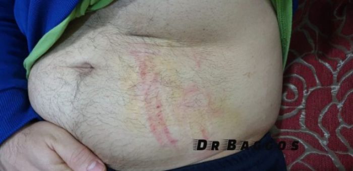 Διακοπή αγώνα στην Ηλεία | Διαιτητής χτυπήθηκε στην κοιλιά από ποδοσφαιριστή!