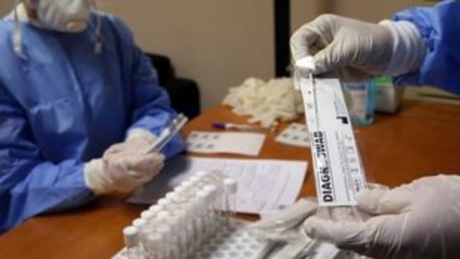 &Kappa;&omicron;&rho;&omega;&nu;&omicron;ϊό&sigmaf; | 152 &nu;έ&alpha; &kappa;&rho;&omicron;ύ&sigma;&mu;&alpha;&tau;&alpha; &sigma;&tau;&eta;&nu; &Epsilon;&lambda;&lambda;ά&delta;&alpha; - &Kappa;&alpha;&nu;έ&nu;&alpha; &sigma;&tau;&eta;&nu; &Pi;&epsilon;&lambda;&omicron;&pi;ό&nu;&nu;&eta;&sigma;&omicron;