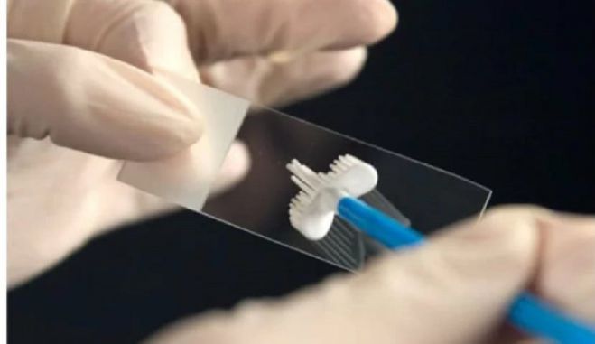 &Delta;&omega;&rho;&epsilon;ά&nu; &pi;&rho;&omicron;&lambda;&eta;&pi;&tau;&iota;&kappa;έ&sigmaf; &epsilon;&xi;&epsilon;&tau;ά&sigma;&epsilon;&iota;&sigmaf; &gamma;&iota;&alpha; &kappa;&alpha;&rho;&kappa;ί&nu;&omicron; &tau;&rho;&alpha;&chi;ή&lambda;&omicron;&upsilon; &tau;&eta;&sigmaf; &mu;ή&tau;&rho;&alpha;&sigmaf; &kappa;&alpha;&iota; &pi;&alpha;&chi;έ&omicron;&sigmaf; &epsilon;&nu;&tau;έ&rho;&omicron;&upsilon;