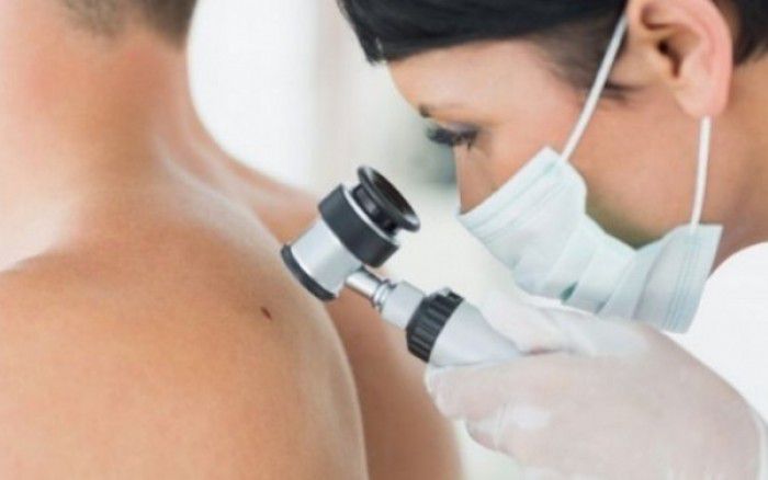 Καρκίνου του Δέρματος: Συμπτώματα και Σημάδια