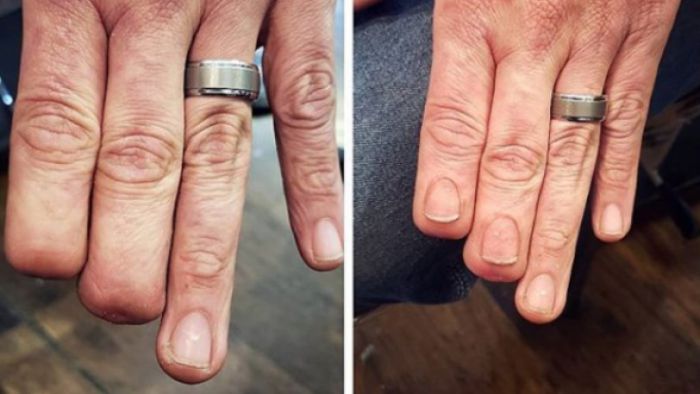 Απέκτησε και πάλι τα δάχτυλά του ... με τατουάζ! (εικόνες)