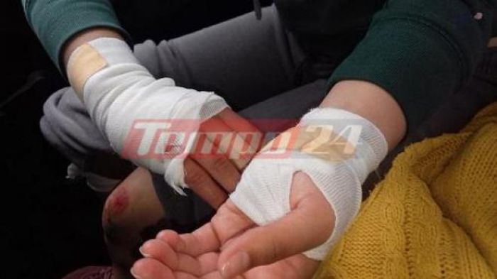 Πάτρα | 20χρονη δέχθηκε επίθεση σκύλων – Βρέθηκε στο νοσοκομείο με ράμματα και πληγές