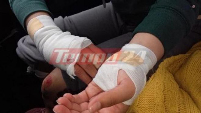 Πάτρα | 20χρονη δέχθηκε επίθεση σκύλων – Βρέθηκε στο νοσοκομείο με ράμματα και πληγές