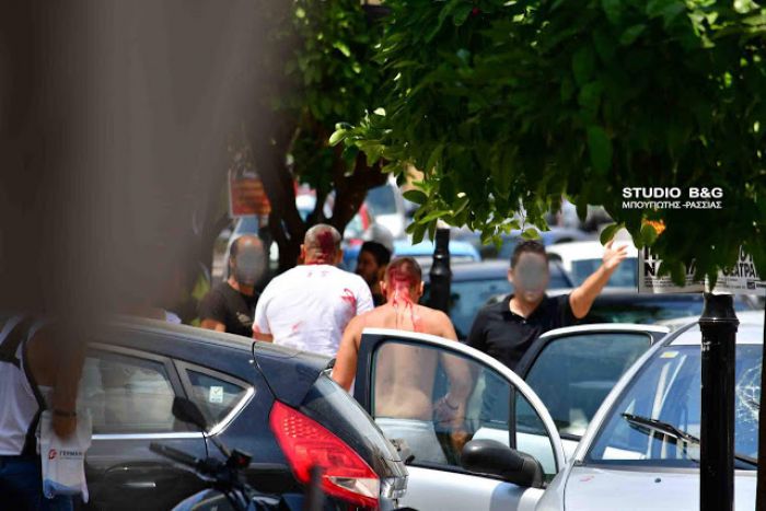 &Sigma;&phi;&alpha;&gamma;ή &sigma;&tau;&omicron; &Nu;&alpha;ύ&pi;&lambda;&iota;&omicron; - &Alpha;&iota;&mu;&alpha;&tau;&eta;&rho;ά &epsilon;&pi;&epsilon;&iota;&sigma;ό&delta;&iota;&alpha; &mu;&epsilon; &Rho;&omicron;&mu;ά &sigma;&tau;&omicron; &kappa;έ&nu;&tau;&rho;&omicron; &tau;&eta;&sigmaf; &pi;ό&lambda;&eta;&sigmaf; (vd)