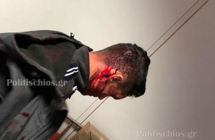 Απρόκλητη επίθεση των ΜΑΤ σε κατοίκους της Χίου