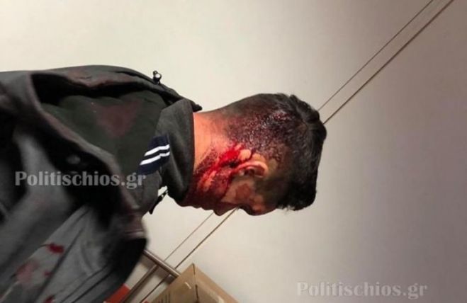 &Alpha;&pi;&rho;ό&kappa;&lambda;&eta;&tau;&eta; &epsilon;&pi;ί&theta;&epsilon;&sigma;&eta; &tau;&omega;&nu; &Mu;&Alpha;&Tau; &sigma;&epsilon; &kappa;&alpha;&tau;&omicron;ί&kappa;&omicron;&upsilon;&sigmaf; &tau;&eta;&sigmaf; &Chi;ί&omicron;&upsilon;