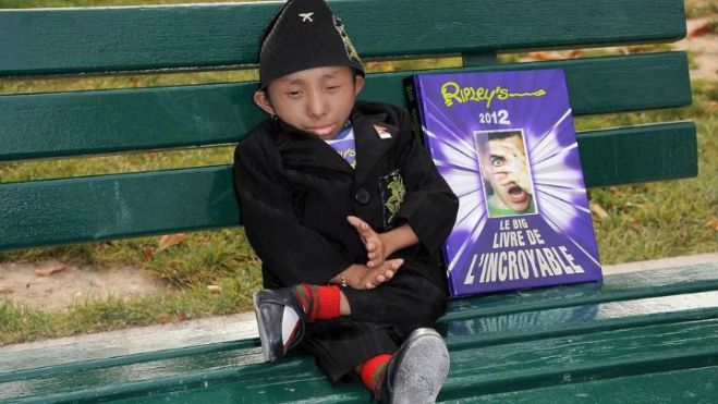 &Alpha;&pi;ό &pi;&nu;&epsilon;&upsilon;&mu;&omicron;&nu;ί&alpha; &pi;έ&theta;&alpha;&nu;&epsilon; &omicron; &pi;&iota;&omicron; &mu;&iota;&kappa;&rho;ό&sigma;&omega;&mu;&omicron;&sigmaf; ά&nu;&theta;&rho;&omega;&pi;&omicron;&sigmaf; &tau;&omicron;&upsilon; &kappa;ό&sigma;&mu;&omicron;&upsilon;!