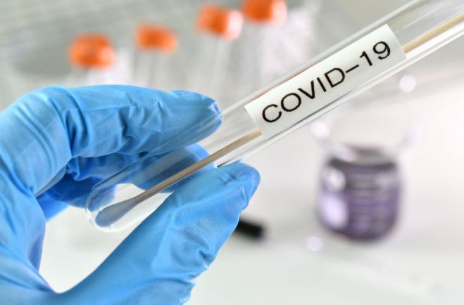 Υποχρέωση τεστ covid για τους ανεμβολίαστους υπαλλήλους της Περιφέρειας Πελοποννήσου