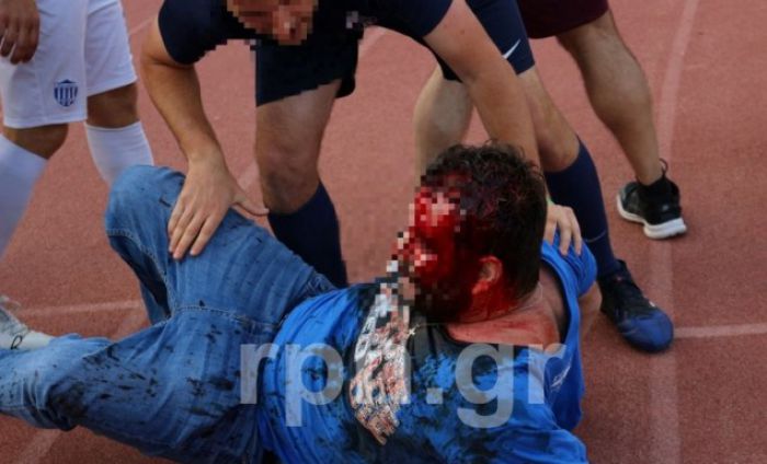 &Tau;&rho;&omicron;&mu;&epsilon;&rho;ά &epsilon;&pi;&epsilon;&iota;&sigma;ό&delta;&iota;&alpha; &sigma;&epsilon; &Sigma;&pi;ά&tau;&alpha;-&Mu;&eta;&chi;&alpha;&nu;&iota;ώ&nu;&alpha;, &kappa;&upsilon;&rho;&iota;&omicron;&lambda;&epsilon;&kappa;&tau;&iota;&kappa;ά &chi;ύ&theta;&eta;&kappa;&epsilon; &alpha;ί&mu;&alpha; (vd)