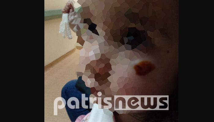 Στο Νοσοκομείο από επίθεση σκύλου κοριτσάκι 2,5 ετών από τον Πύργο