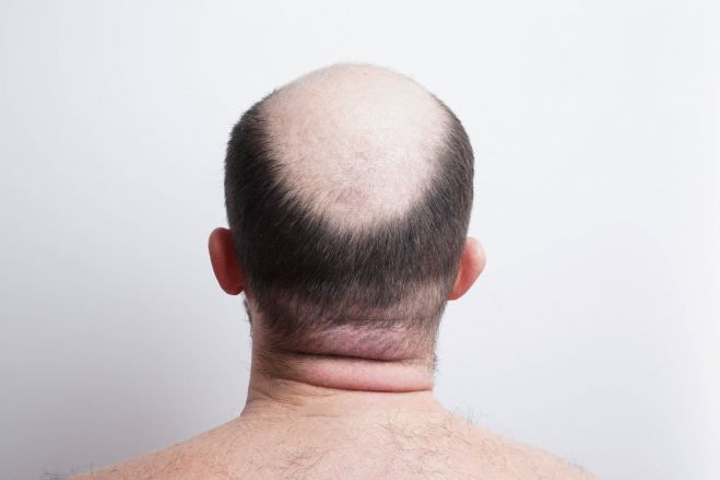 Έ&rho;&chi;&epsilon;&tau;&alpha;&iota; &tau;&omicron; &epsilon;&mu;&beta;ό&lambda;&iota;&omicron; &gamma;&iota;&alpha; &tau;&eta; &phi;&alpha;&lambda;ά&kappa;&rho;&alpha;