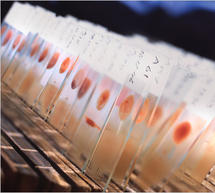 &Beta;&omicron;ή&theta;&epsilon;&iota;&alpha; &gamma;&iota;&alpha; &tau;&eta;&nu; &alpha;&nu;&tau;&iota;&mu;&epsilon;&tau;ώ&pi;&iota;&sigma;&eta; &tau;&eta;&sigmaf; &epsilon;&lambda;&omicron;&nu;&omicron;&sigma;ί&alpha;&sigmaf; &zeta;&eta;&tau;ά &omicron; &Delta;ή&mu;&omicron;&sigmaf; &Epsilon;&upsilon;&rho;ώ&tau;&alpha;
&sigma;&tau;&eta; &Lambda;&alpha;&kappa;&omega;&nu;ί&alpha;