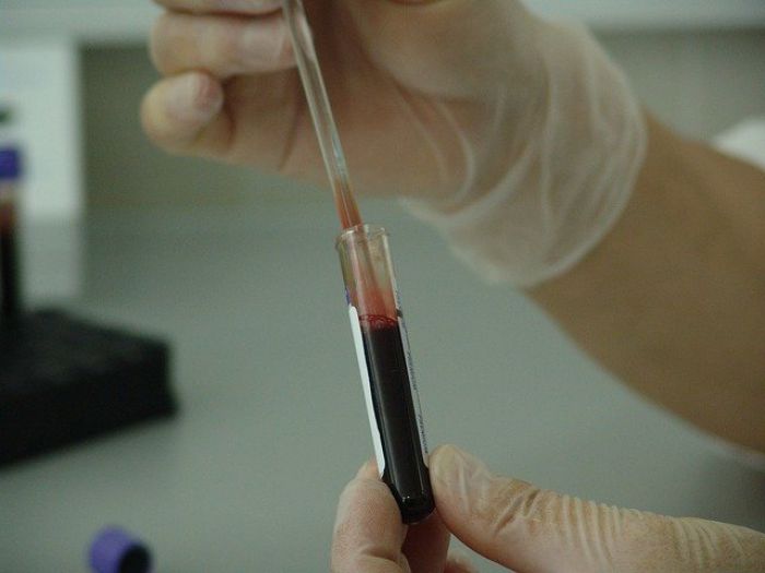 Υγεία | "Τα κρούσματα καρκίνου στις φτωχές χώρες θα αυξηθούν κατά 81% ως το 2040"