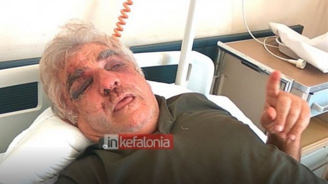 &Alpha;&pi;ί&sigma;&tau;&epsilon;&upsilon;&tau;&eta; &alpha;&gamma;&rho;&iota;ό&tau;&eta;&tau;&alpha; &sigma;&epsilon; &lambda;&eta;&sigma;&tau;&epsilon;ί&alpha; &sigma;&tau;&eta;&nu; &Kappa;&epsilon;&phi;&alpha;&lambda;&lambda;&omicron;&nu;&iota;ά | &laquo;&Mu;&alpha;&sigmaf; &chi;&tau;&upsilon;&pi;&omicron;ύ&sigma;&alpha;&nu; ά&gamma;&rho;&iota;&alpha; &mu;&epsilon; &sigma;&iota;&delta;&epsilon;&rho;έ&nu;&iota;&epsilon;&sigmaf; &mu;&alpha;&gamma;&kappa;&omicron;ύ&rho;&epsilon;&sigmaf;!&raquo;