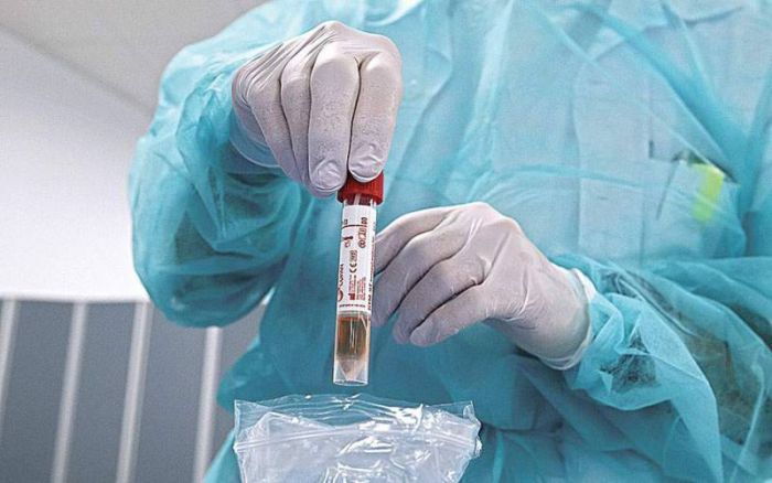 &Kappa;&omicron;&rho;&omega;&nu;&omicron;ϊό&sigmaf; | 264 &kappa;&rho;&omicron;ύ&sigma;&mu;&alpha;&tau;&alpha; &sigma;&tau;&eta;&nu; &Epsilon;&lambda;&lambda;ά&delta;&alpha; - &Delta;&epsilon;ί&tau;&epsilon; &sigma;&epsilon; &pi;&omicron;&iota;&epsilon;&sigmaf; &pi;&epsilon;&rho;&iota;&omicron;&chi;έ&sigmaf;