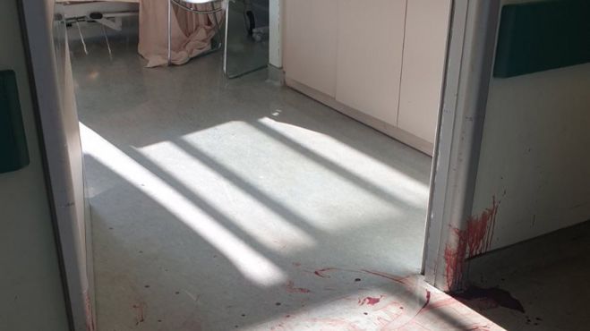Νοσοκομείο Αττικόν | Ασθενής μαχαίρωσε νοσηλεύτρια και αυτοκτόνησε (vd)