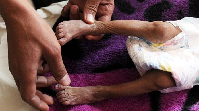 &Beta;ί&nu;&tau;&epsilon;&omicron; &sigma;&omicron;&kappa; &alpha;&pi;ό &tau;&eta;&nu; &Upsilon;&epsilon;&mu;έ&nu;&eta; | 130 &pi;&alpha;&iota;&delta;&iota;ά &pi;&epsilon;&theta;&alpha;ί&nu;&omicron;&upsilon;&nu; &alpha;&pi;ό &alpha;&sigma;&iota;&tau;ί&alpha; &kappa;ά&theta;&epsilon; &mu;έ&rho;&alpha; (vd)