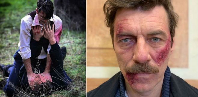 Ά&gamma;&rho;&iota;&epsilon;&sigmaf; &Mu;έ&lambda;&iota;&sigma;&sigma;&epsilon;&sigmaf; | Έ&phi;&alpha;&gamma;&epsilon; &pi;&omicron;&lambda;ύ &xi;ύ&lambda;&omicron; &omicron; &Theta;&omega;&mu;ά&sigmaf; &Kappa;&upsilon;&pi;&rho;&alpha;ί&omicron;&sigmaf; - &Eta; &alpha;&pi;&omicron;&kappa;ά&lambda;&upsilon;&psi;&eta; &alpha;&pi;ό &tau;&omicron;&nu; &Gamma;&iota;ά&nu;&nu;&eta; &Sigma;&tau;ά&nu;&kappa;&omicron;&gamma;&lambda;&omicron;&upsilon;