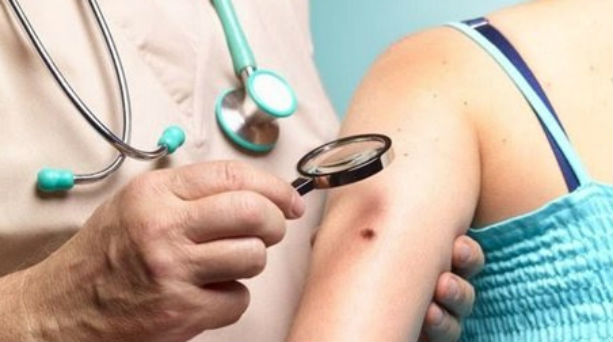 &Delta;&omega;&rho;&epsilon;ά&nu; &epsilon;&xi;&epsilon;&tau;ά&sigma;&epsilon;&iota;&sigmaf; &gamma;&iota;&alpha; &pi;&iota;&theta;&alpha;&nu;ό &mu;&epsilon;&lambda;ά&nu;&omega;&mu;&alpha; ή ά&lambda;&lambda;&eta; &mu;&omicron;&rho;&phi;ή &kappa;&alpha;&rho;&kappa;ί&nu;&omicron;&upsilon; &tau;&omicron;&upsilon; &delta;έ&rho;&mu;&alpha;&tau;&omicron;&sigmaf; &sigma;&tau;&eta;&nu; &Tau;&rho;ί&pi;&omicron;&lambda;&eta;!
