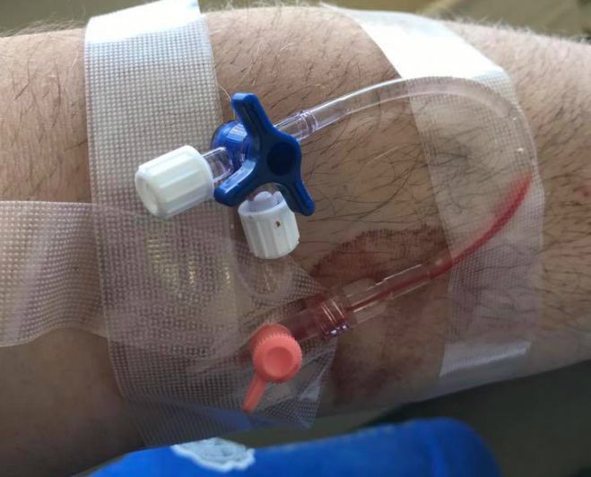 Αληθινή ιστορία: Τραυματίστηκε στη Γορτυνία – Κανείς περαστικός δεν σταματούσε να τον μεταφέρει στο Κέντρο Υγείας