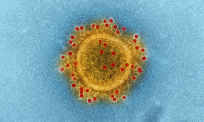 Covid-19 | &Epsilon;ί&nu;&alpha;&iota; &epsilon;&pi;&iota;&beta;&alpha;&rho;&upsilon;&nu;&tau;&iota;&kappa;ό&sigmaf; &pi;&alpha;&rho;ά&gamma;&omicron;&nu;&tau;&alpha;&sigmaf; &tau;&alpha; &Alpha;&upsilon;&tau;&omicron;ά&nu;&omicron;&sigma;&alpha; &Nu;&omicron;&sigma;ή&mu;&alpha;&tau;&alpha;;