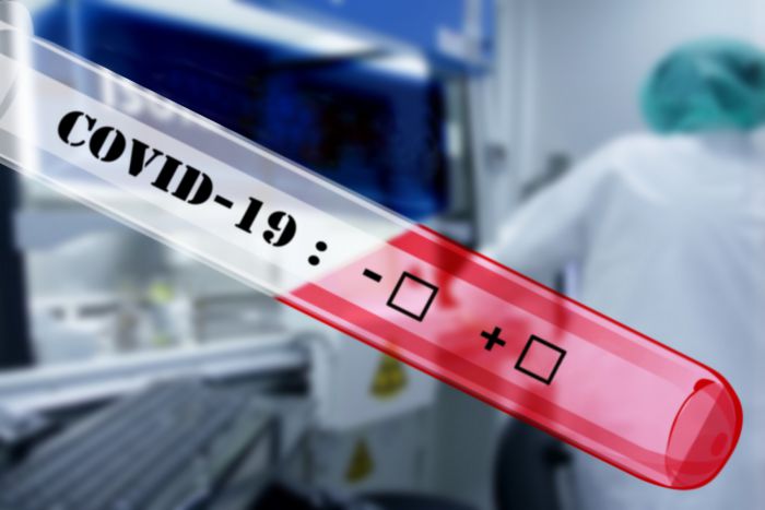 &Alpha;&rho;&nu;&eta;&tau;&iota;&kappa;ά tests covid &sigma;&tau;&eta; &Beta;ό&rho;&epsilon;&iota;&alpha; &Kappa;&upsilon;&nu;&omicron;&upsilon;&rho;ί&alpha;