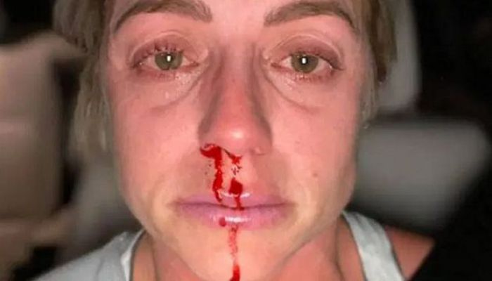 &laquo;&Mu;&alpha;ύ&rho;&epsilon;&sigmaf;&raquo; &alpha;&pi;ό &tau;&omicron; &xi;ύ&lambda;&omicron; &sigma;&tau;&eta;&nu; &kappa;&alpha;&rho;&alpha;&nu;&tau;ί&nu;&alpha; &ndash; &Gamma;&upsilon;&nu;&alpha;ί&kappa;&epsilon;&sigmaf; &delta;&epsilon;ί&chi;&nu;&omicron;&upsilon;&nu; &tau;&omicron; &mu;&epsilon;&lambda;&alpha;&nu;&iota;&alpha;&sigma;&mu;έ&nu;&omicron; &pi;&rho;ό&sigma;&omega;&pi;ό &tau;&omicron;&upsilon;&sigmaf; (&epsilon;&iota;&kappa;ό&nu;&epsilon;&sigmaf;)