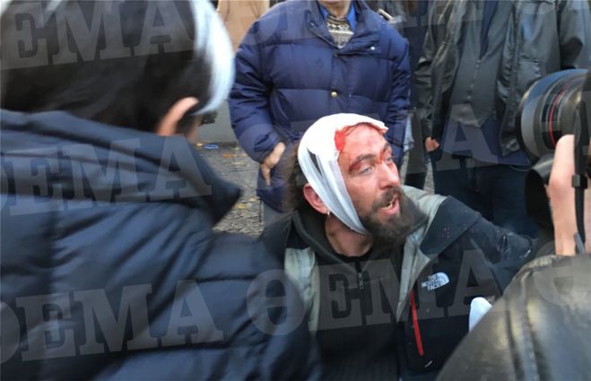 &Sigma;ύ&nu;&tau;&alpha;&gamma;&mu;&alpha; | Ά&gamma;&rho;&iota;&alpha; &epsilon;&pi;&epsilon;&iota;&sigma;ό&delta;&iota;&alpha;, &mu;&alpha;&chi;&alpha;&iota;&rho;ώ&mu;&alpha;&tau;&alpha; &kappa;&alpha;&iota; &lambda;&iota;&pi;ό&theta;&upsilon;&mu;&alpha; &pi;&alpha;&iota;&delta;&iota;ά &alpha;&pi;ό &chi;&eta;&mu;&iota;&kappa;ά (&epsilon;&iota;&kappa;ό&nu;&epsilon;&sigmaf;)