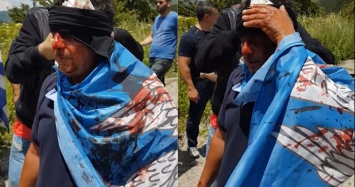 Συγκλονίζει ο 42χρονος διαδηλωτής με την ματωμένη σημαία για το ξύλο που έπεσε από τα ΜΑΤ στις Πρέσπες (vd)