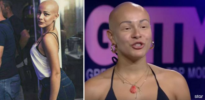 &Eta; &Lambda;&upsilon;&delta;ί&alpha; &pi;ή&gamma;&epsilon; &sigma;&tau;&omicron; GNTM 2 &mu;&epsilon; &alpha;&lambda;&omega;&pi;&epsilon;&kappa;ί&alpha; (vd)