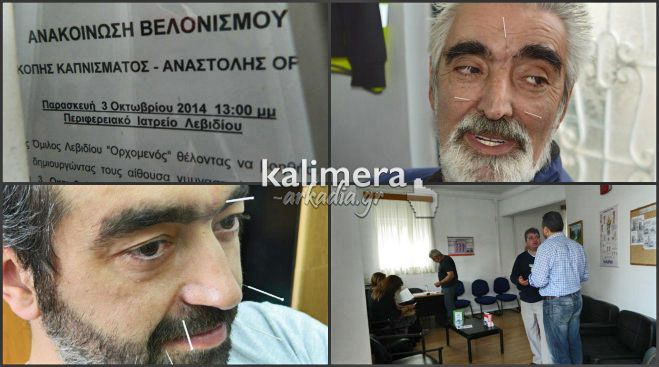 Βελονισμός για να «κοπεί» το τσιγάρο από τον Ορχομενό – Με τα έσοδα θα γίνει γυμναστήριο στο Λεβίδι (vd)!
