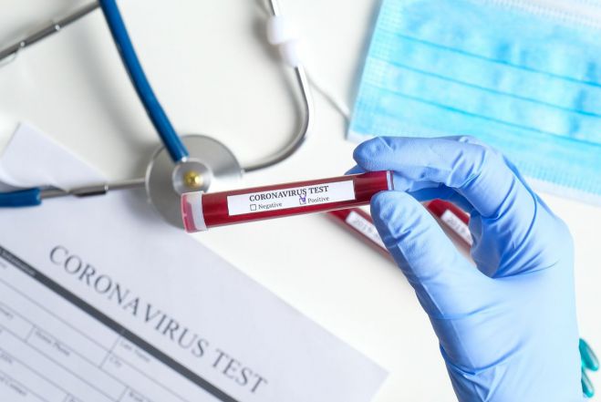 &Xi;&alpha;&nu;ά &alpha;&rho;&nu;&eta;&tau;&iota;&kappa;ά &tau;&alpha; &tau;&epsilon;&sigma;&tau; &alpha;&nu;ί&chi;&nu;&epsilon;&upsilon;&sigma;&eta;&sigmaf; &kappa;&omicron;&rho;&omega;&nu;&omicron;ϊ&omicron;ύ &sigma;&tau;&eta;&nu; &omicron;&mu;ά&delta;&alpha; &tau;&omicron;&upsilon; &Alpha;&sigma;&tau;έ&rho;&alpha;!
